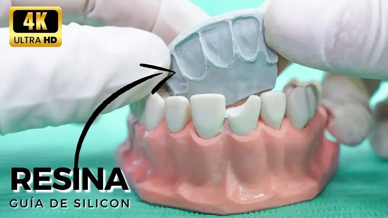 llave de silicon dental - Cuánto tiempo dura una impresión de silicona