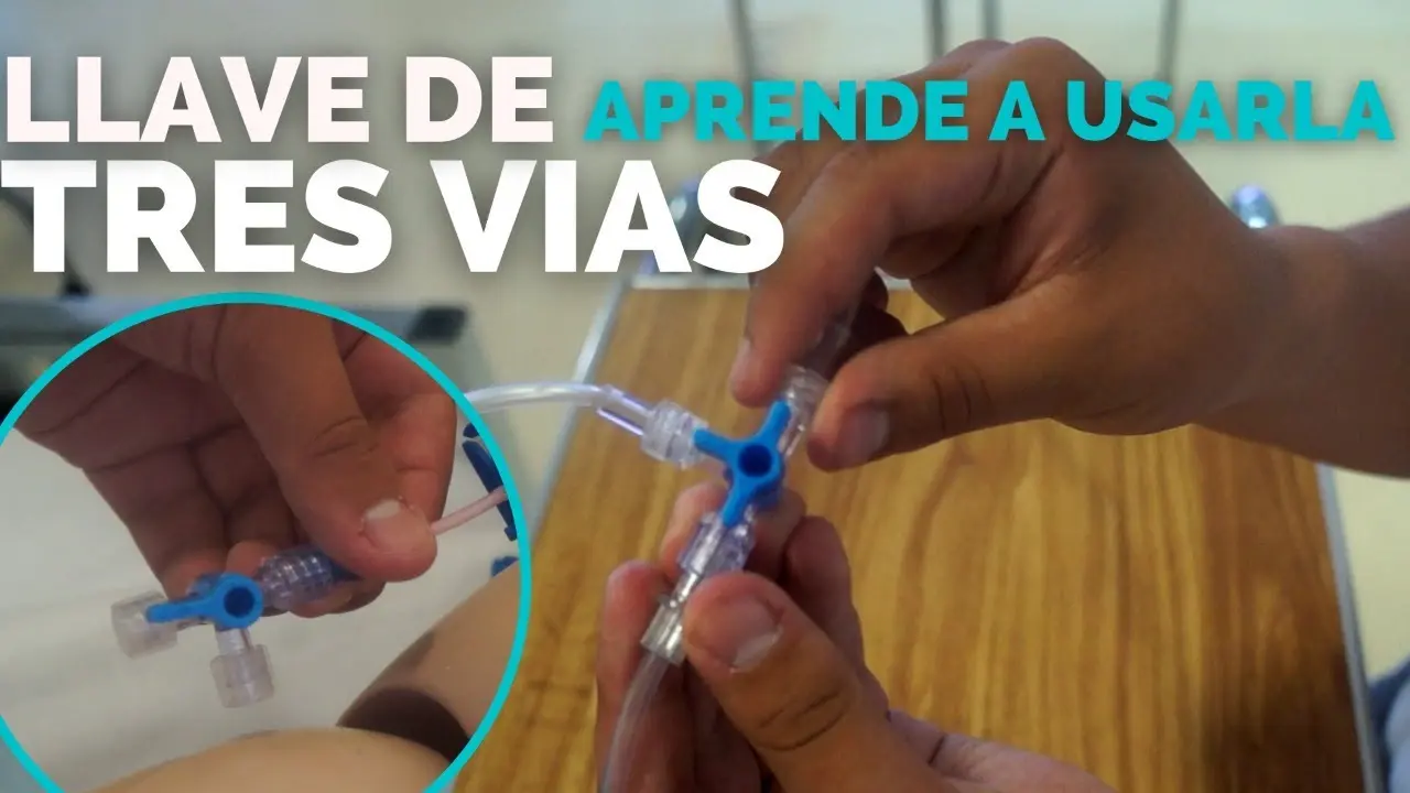 llave de tres pasos enfermeria - Qué hacer cuando se obstruye la vía endovenosa